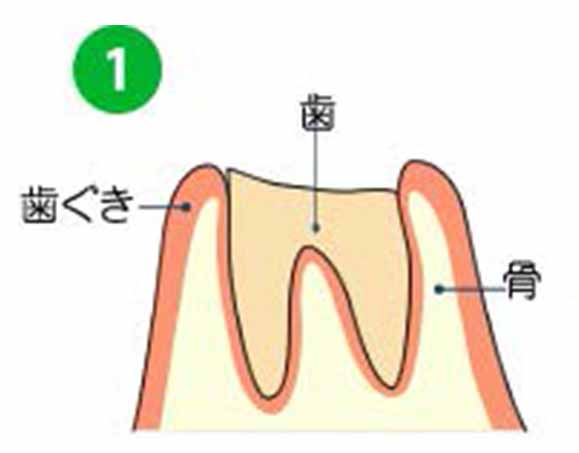 歯の根の部分だけが残っています