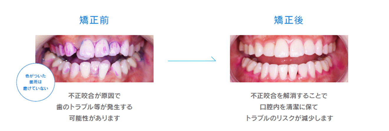 清掃性