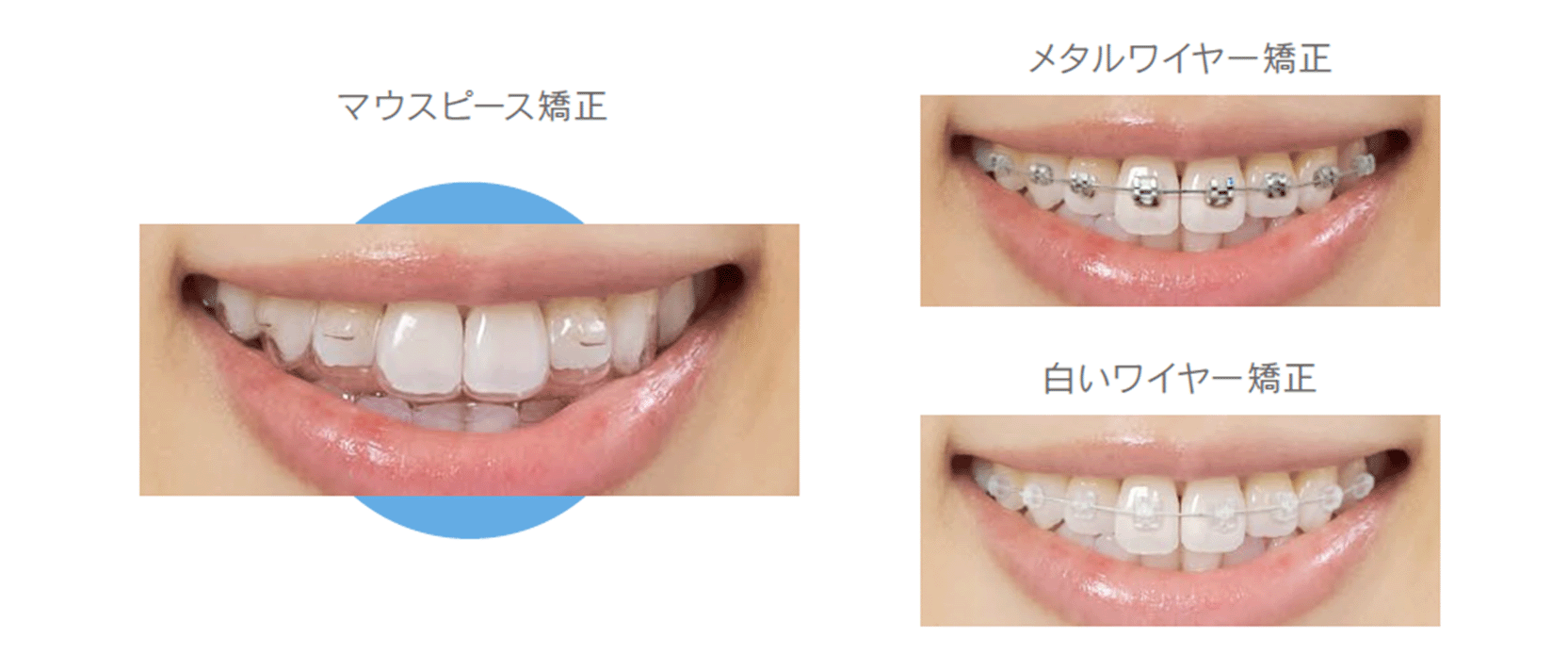 認定医が治療します